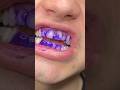 Does Purple Toothpaste Actually Work ️