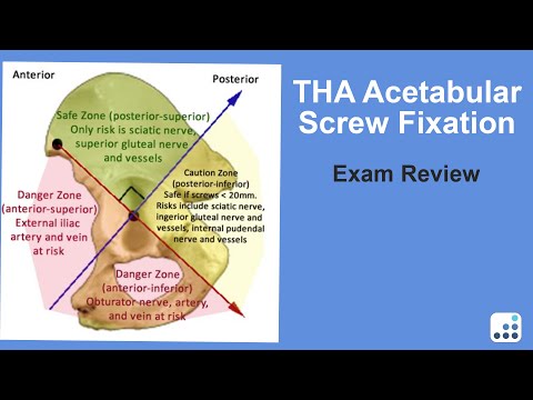 THA Acetabular Screw Fixation Exam Review, MD