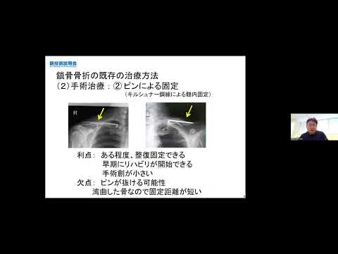 機械・ロボット学科 「鎖骨骨折治療用の髄内固定金具の開発」久留米大学　医学部　整形外科学講座　講師　中村 英智