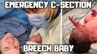 OUR BIRTH STORY | EMERGENCY C-SECTION | BREECH BIRTH