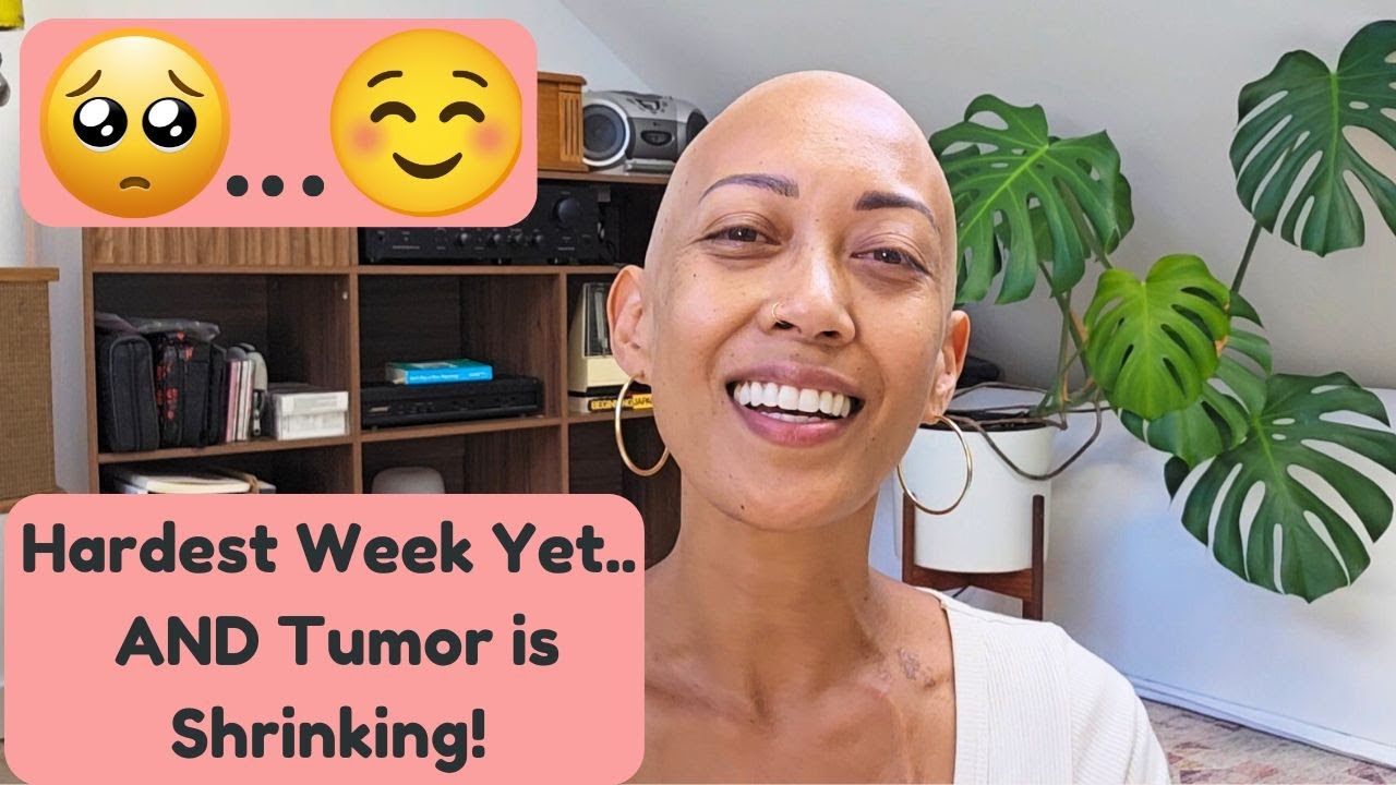 Chemo Round 3 - Hardest Yet.. and Signs of Healing! Plus, Starting Life Coaching Program :)