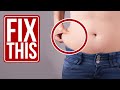 How to Lose Lower Ab & Hip Fat? (Love Handles)