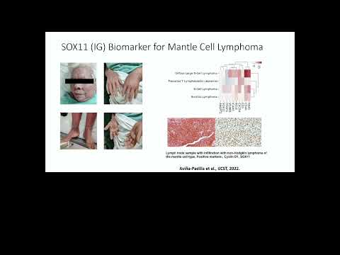 Identifying potential driver genes by multi-omics approaches: a... - Katia Avina-Padilla - LA 2022