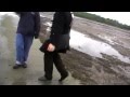 DVD Extra B Roll Footage From Russia A Hysterectomy