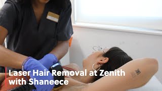 Laser Hair Removal at Zenith with Shaneece