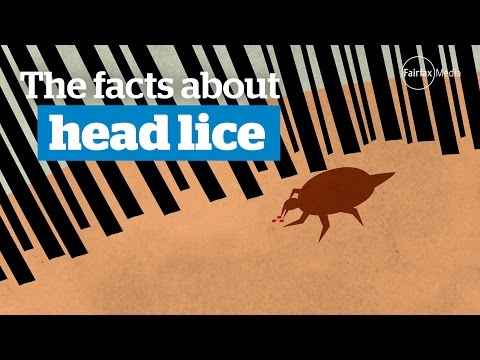 Head lice - the facts