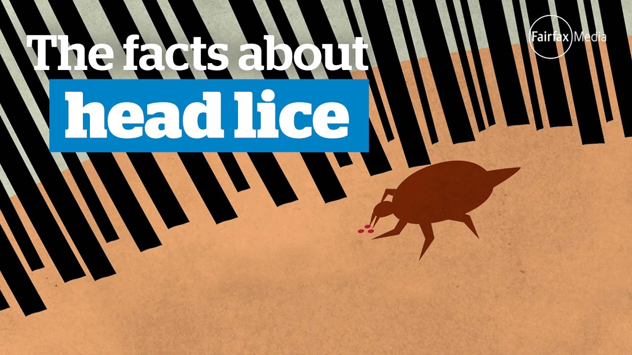 Head lice - the facts