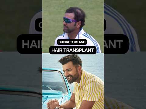 Cricketers who have undergone Hair transplant.
