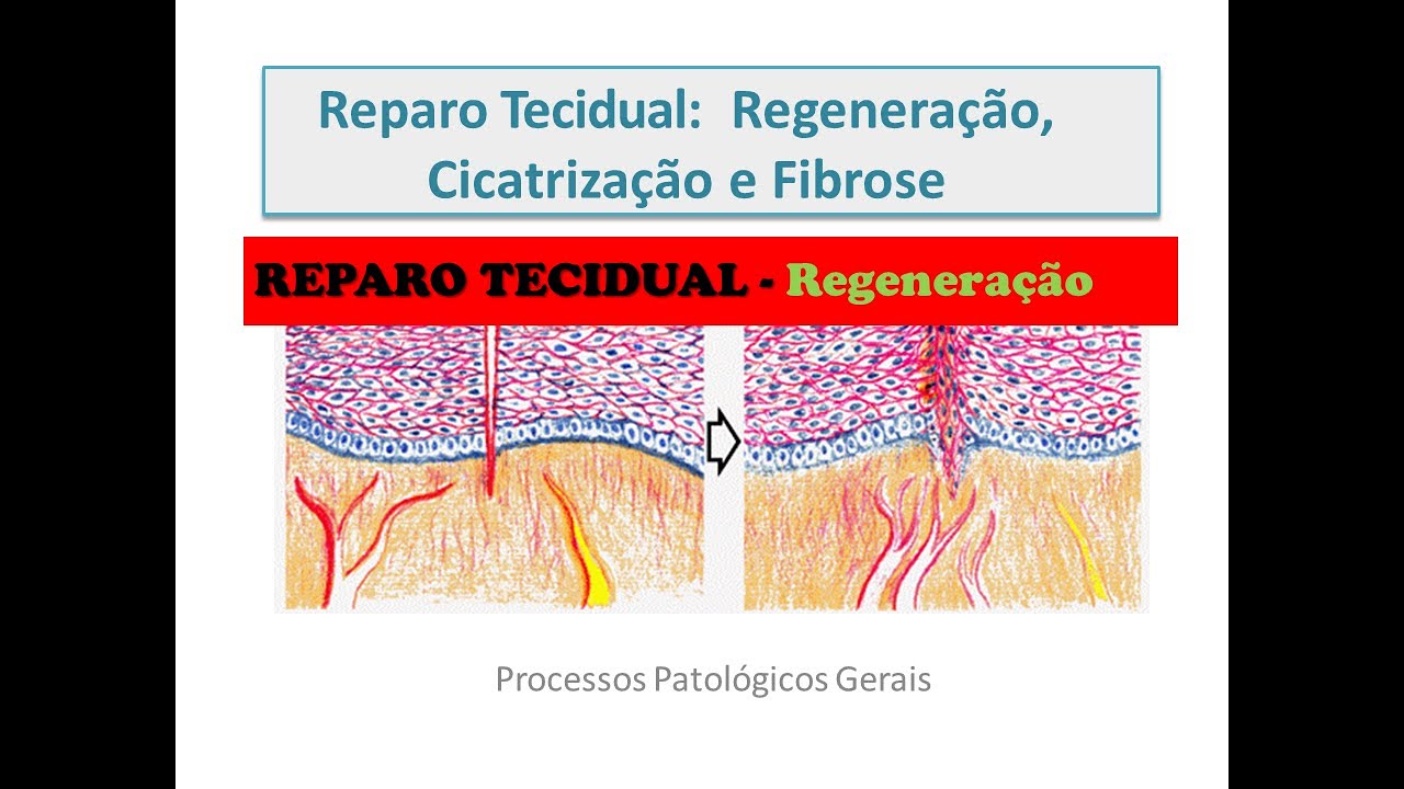 Reparo Tecidual   Regeneração