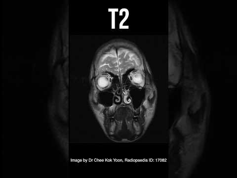 Paint Thinner Brain Damage 🧠