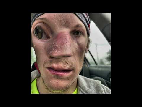 THC DRO - Smiles (Official Audio)