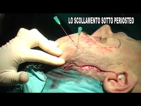 Le maschere per faccia si staccano con miele Lemergenza maschera per occhi