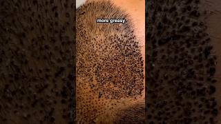 What happens if you stopped washing washing your hair?