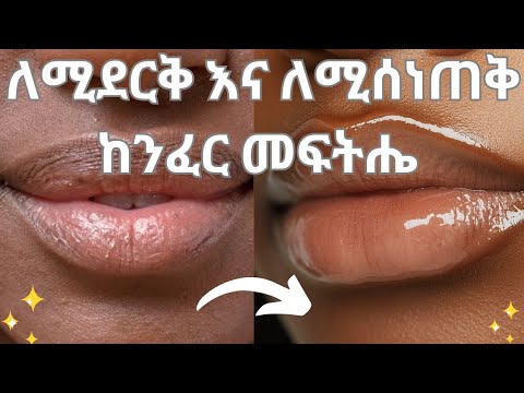 🌸ለሚደርቅ ለሚላጥ እና ዳሩ ለሚጠቁር ከንፈር መፍትሔ 👍//Tips to get soft lips