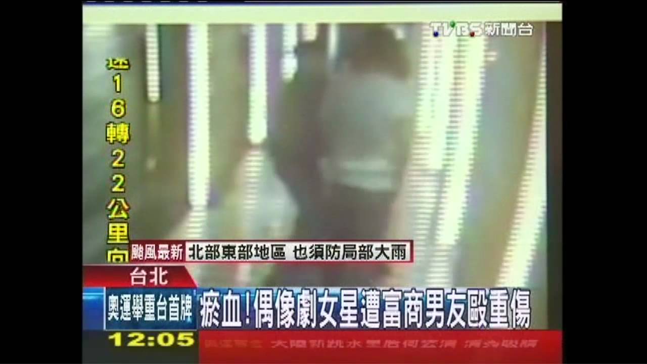 瘀血! 偶像劇女星遭富商男友毆重傷