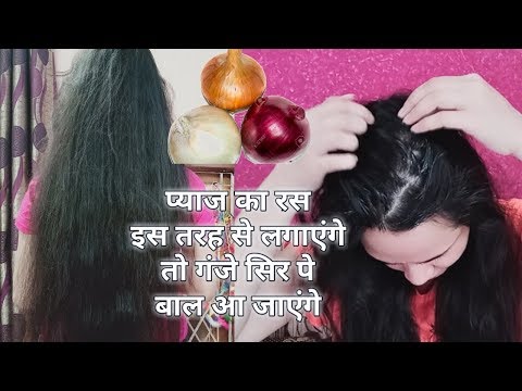 प्याज का रस बालो में कैसे लगाए | Grow long and thicken hair naturally and faster