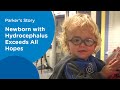 Quand le bébé naît, il a une tête gigantesque. Mais 9 ans plus tard? Même les médecins sont sous le choc devant sa transformation