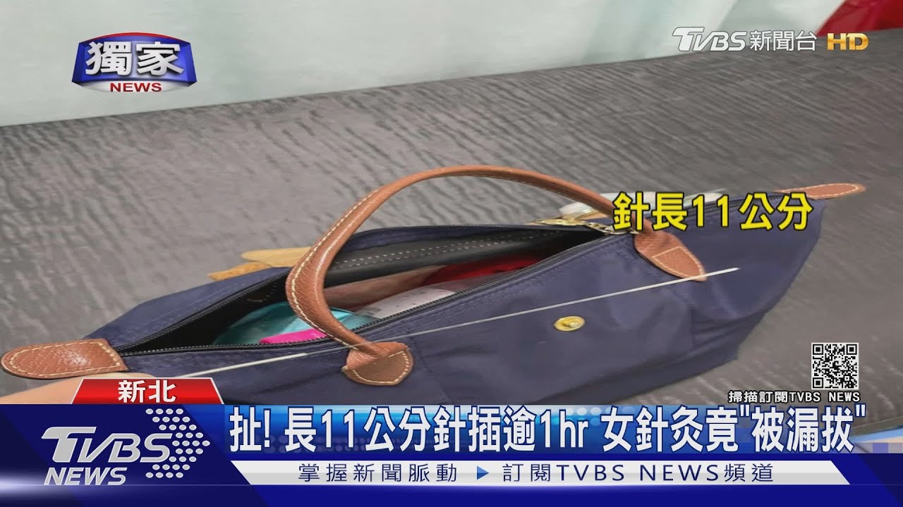 扯！長11公分針插逾1hr　女針灸竟「被漏拔」