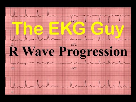 EKG/ECG R Wave Progression - Question 12.0 | The EKG Guy