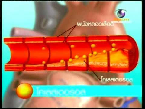 เครื่องมือเพื่อเพิ่มความแข็งแรง สูตรวูดูการรักษาความอ่อนแอ