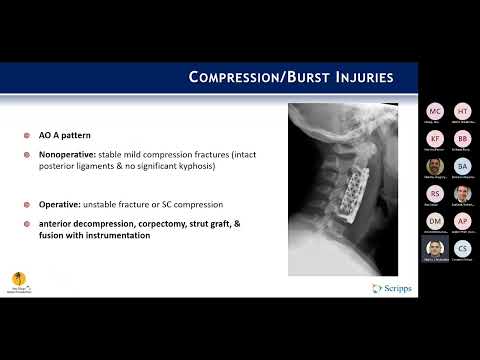 Subaxial Cervical Spine Trauma presented by Christopher Martin, MD on October 17, 2022.