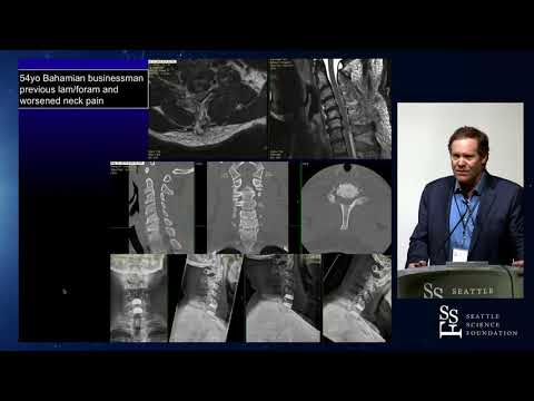 Motion Preservation: An Update - J. Patrick Johnson, MD