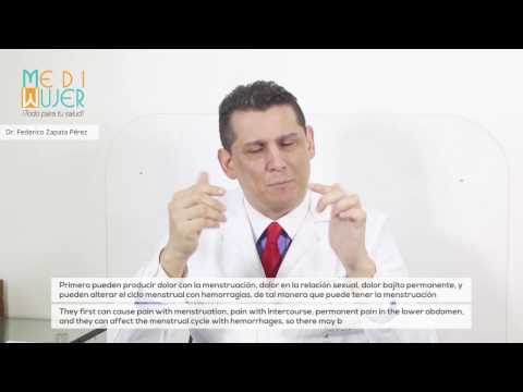 Qué son los Miomas? MediMujer, Dr. Federico Zapata, (574) 235 4280 Medellín