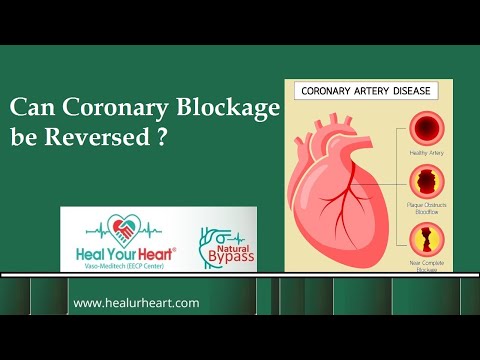 Can Coronary Artery Blockage be Reversed?