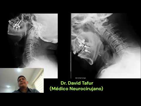 David Tafur Muñoz-3529