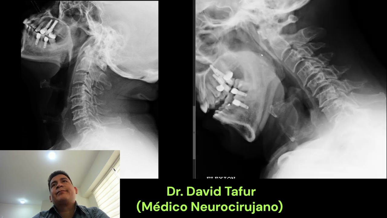 David Tafur Muñoz-2463