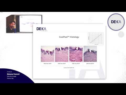 SMARTXIDE PUNTO WEBINAR