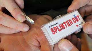Simple Trick Removes Splinter Easier