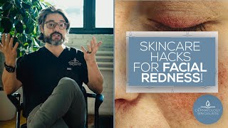 Skincare Hacks for Facial Redness!