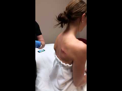 Pain-free laser tattoo removal at Juvanew