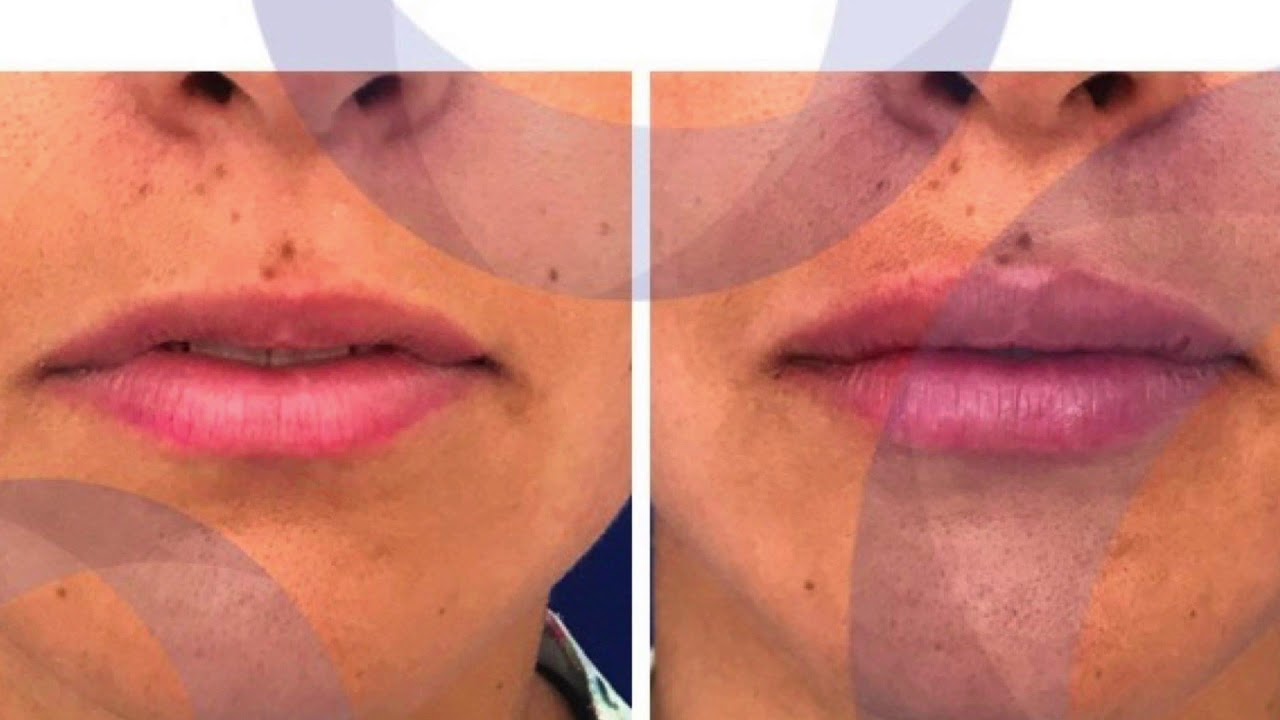 José Cortés Arreguin-48