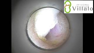 耳掃除動画vol.43「アップ希望 耳垢が取れると気持ちいい」