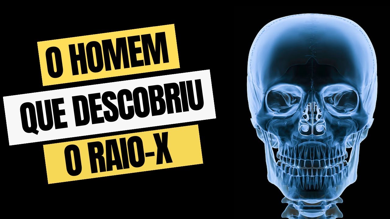 Wilhelm Roentgen: Entre a Descoberta do Raio-X e a "Loucura"