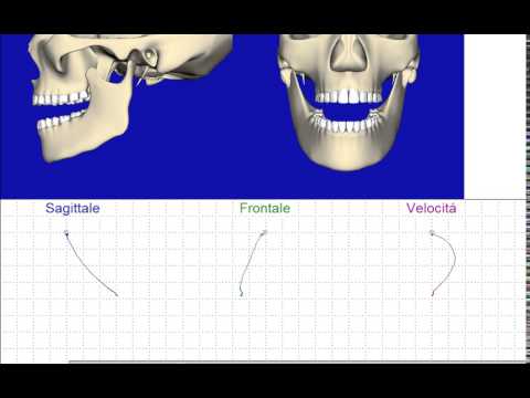Ernia del rachide cervicale esercita sintomi Hip parted