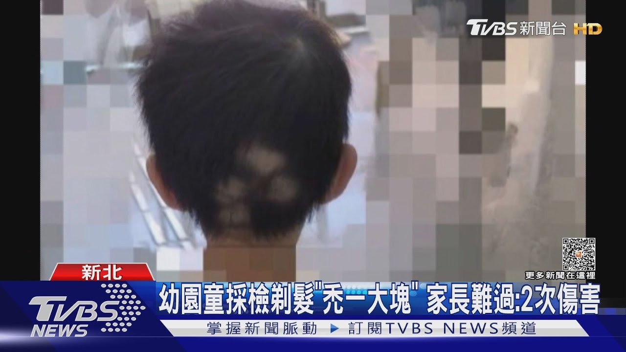 幼園童採檢剃髮「禿一大塊」 家長難過:2次傷害