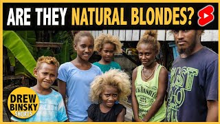 NATURAL BLONDES WITH DARK SKIN?