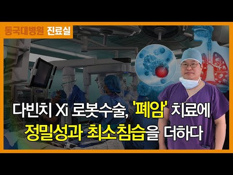 다빈치 로봇수술 폐암 치료