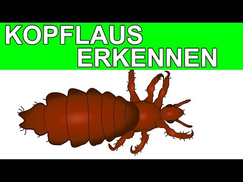 Gelenke knarren beim Gehen Ortroz Kniegelenk als heilen