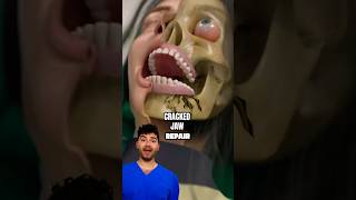 Dentist Explains: Cracked Jaw Repair !?