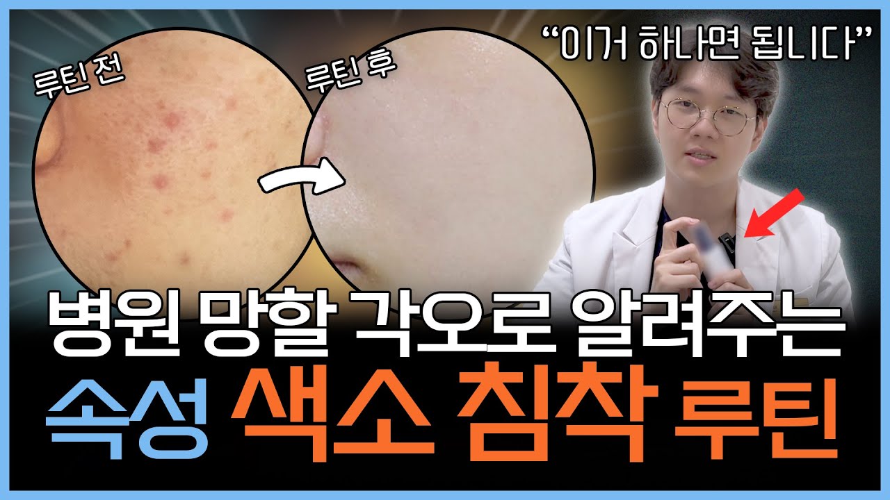 빠른 효과 보장! 피부과 안가고 색소침착 없애는 마법의 루틴