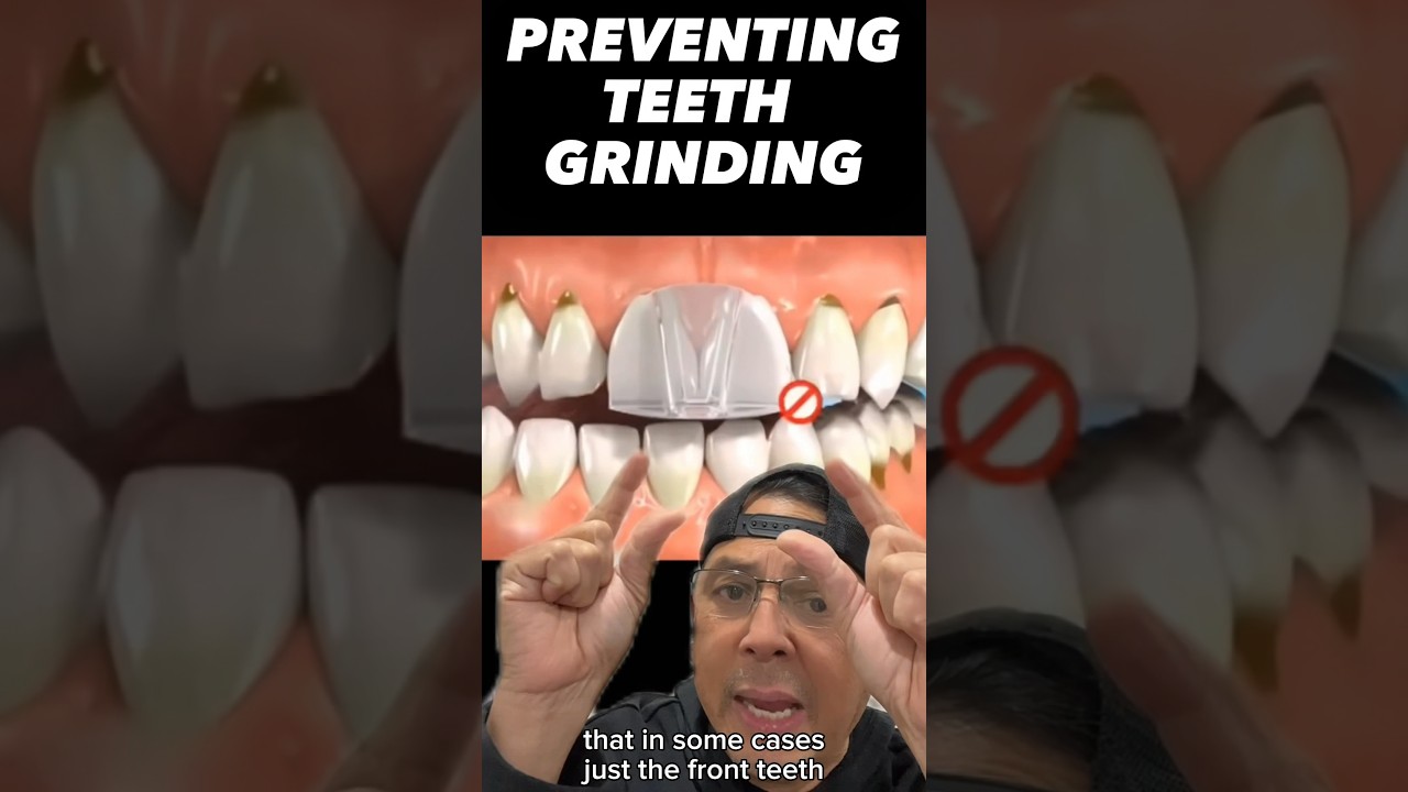 How to Prevent Teeth Grinding During Sleep (Wear an Occlusal Guard) | View Mobile Dental #shorts