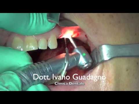 Bendaggio per larticolazione della spalla si-301 Ufa Bodyflex per le articolazioni