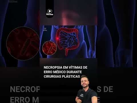 NECROPSIA EM VÍTIMAS DE ERRO MÉDICO