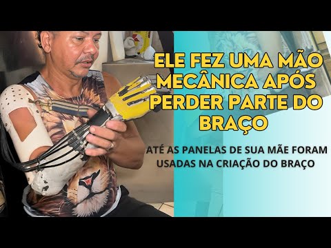 HOMEM FAZ PRÓPRIA PRÓTESE DE BRAÇO - ELE USOU SUCATA E ATÉ AS PANELAS DA MÃE