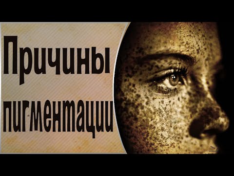 Убрать пигментные пятна лице после родов Защитный крем от солнца и пигментных пятен для лица