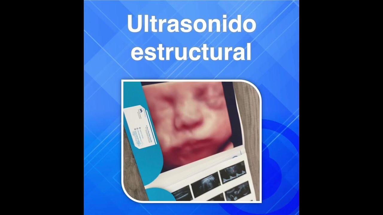 Manuel Ulises Reyes Hernández-15